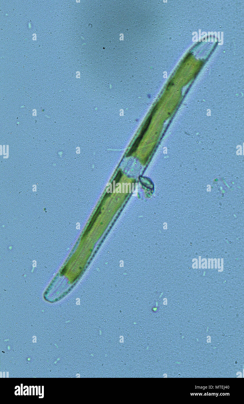 Diatom.Seawed.Algae.Optic microscopy Stock Photo