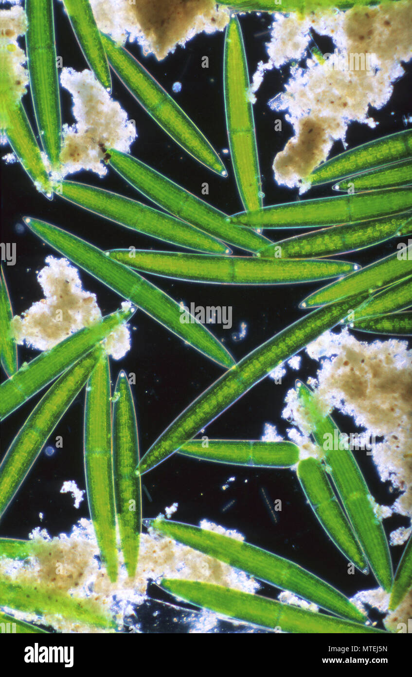 Closterium.Chlorophyta.Algae.Optic microscopy Stock Photo
