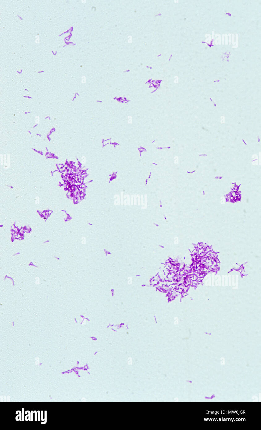 Clostridium tetani.Bactery of TetaniGram Stock Photo