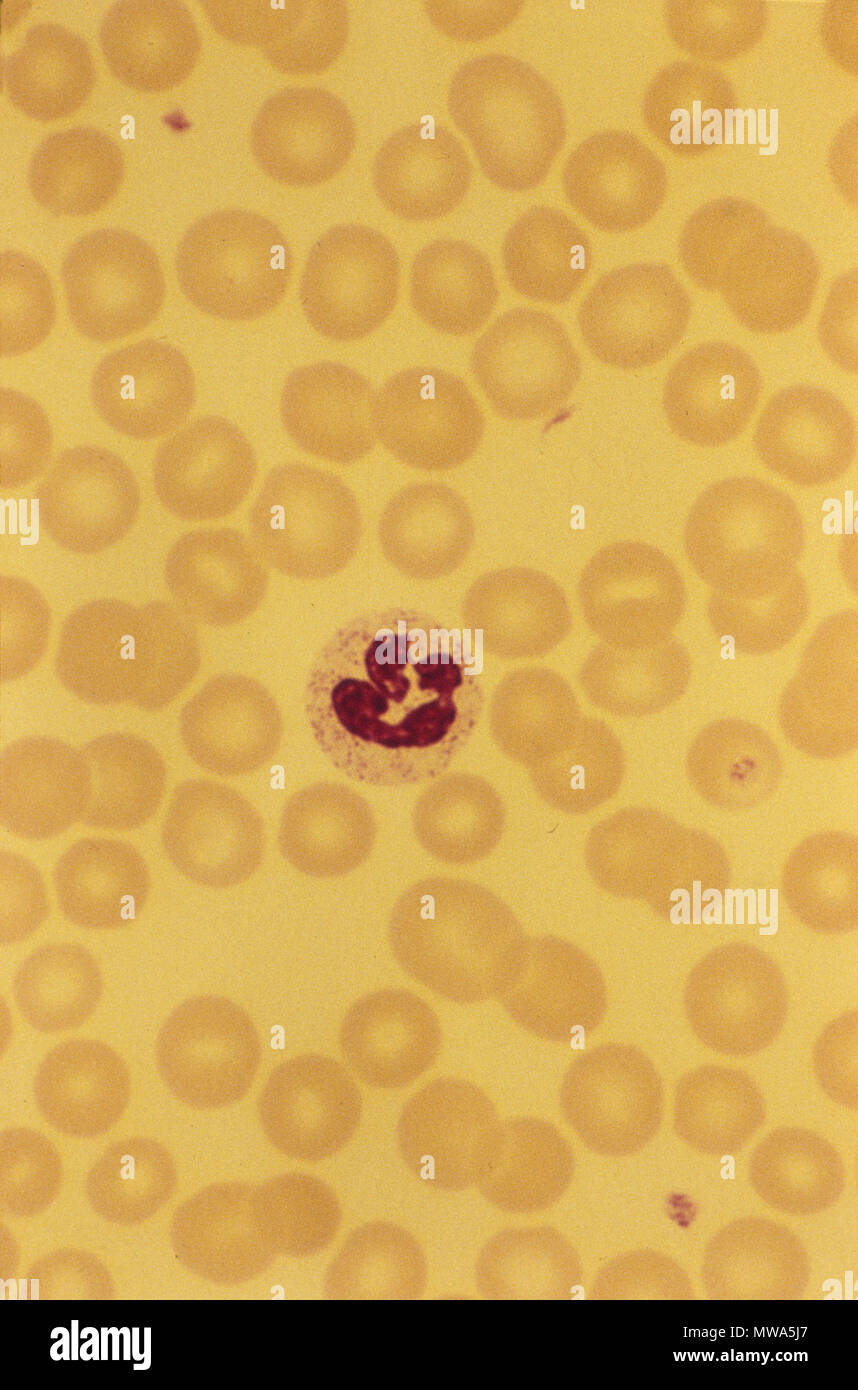 Neutrophil.Phagocyte.White globule Stock Photo