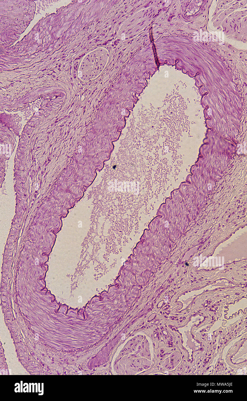Venule.Blood vessel.Circulatory tissue.35x Stock Photo
