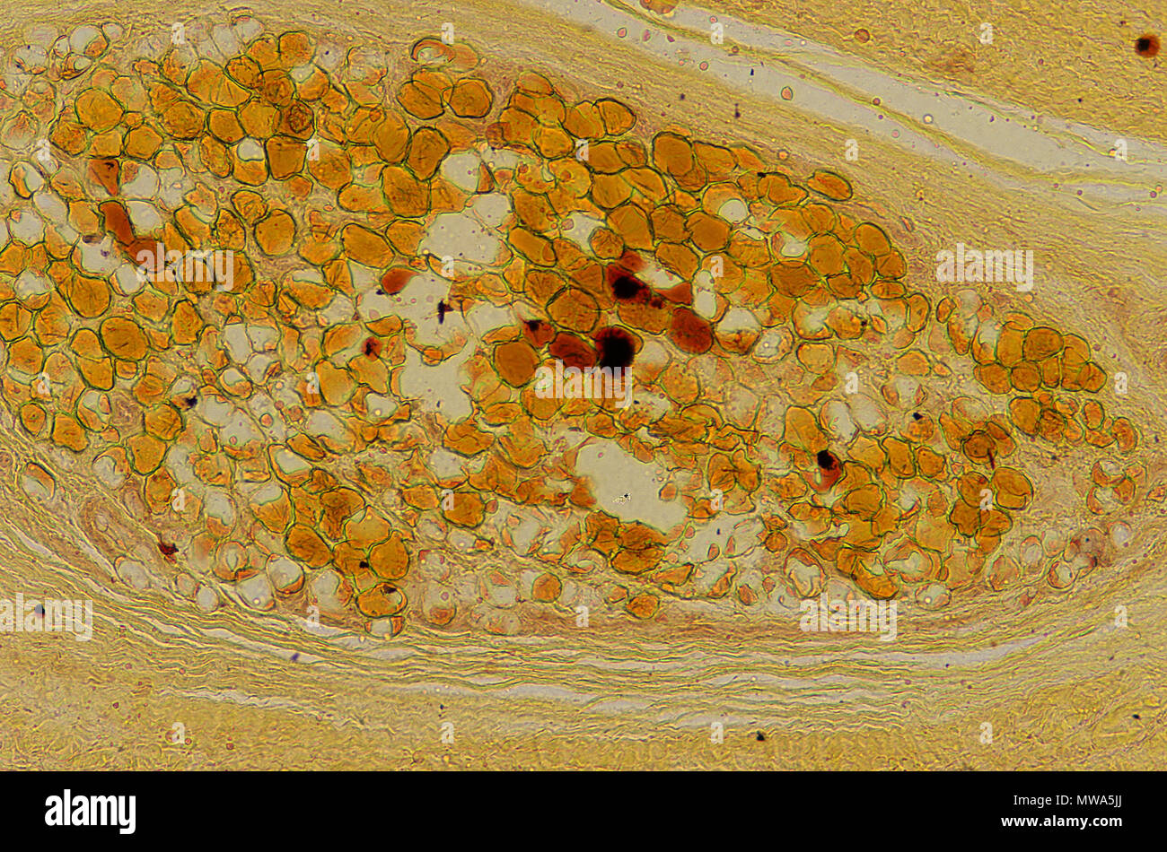 Adypocites.Adipose tissue.35x Stock Photo