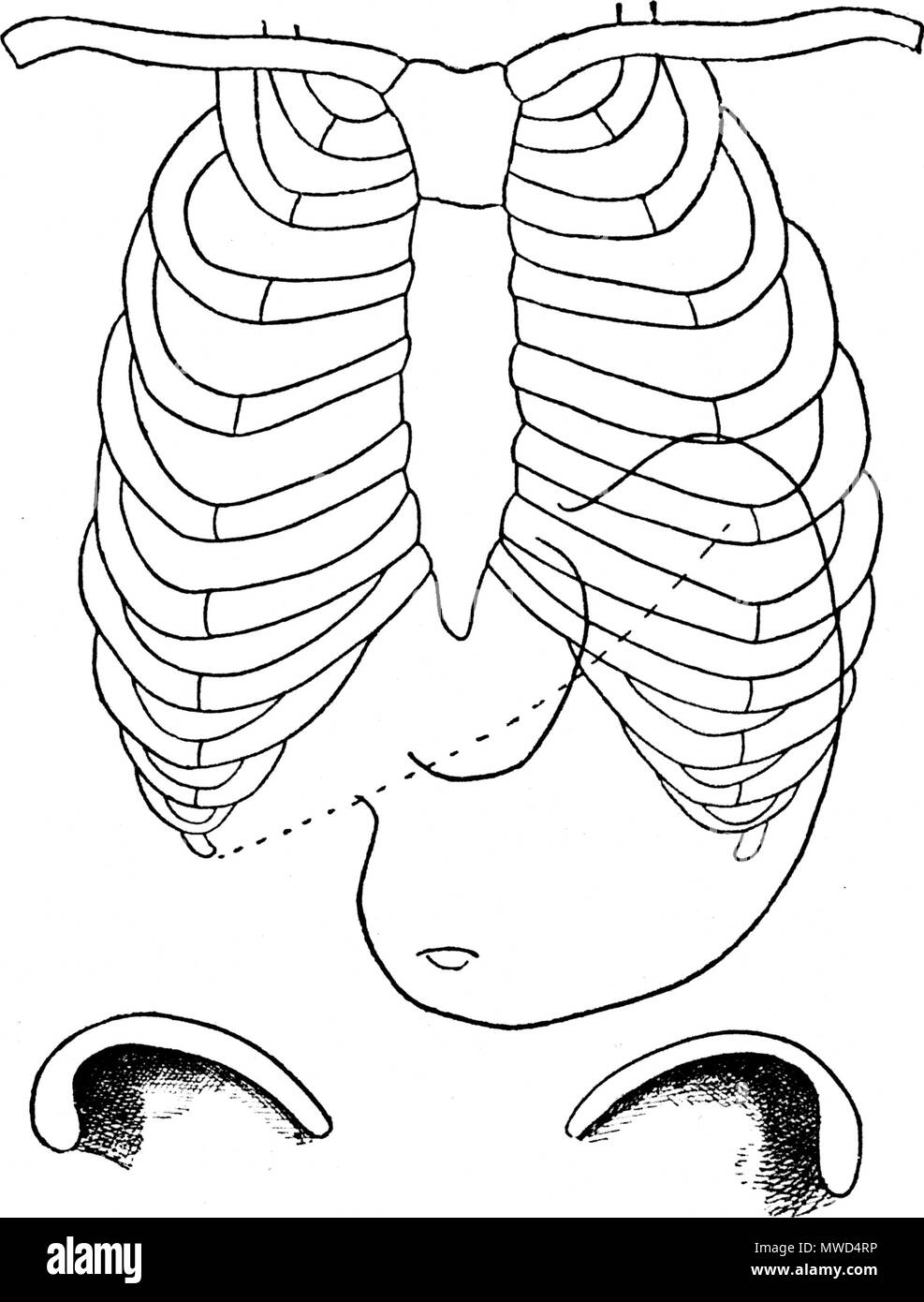 . Français : Figure 19 (d'après Rosenheim). POSITION VERTICALE DE L'ESTOMAC, DE DIMENSIONS NORMALES. Sa situation pendant le gonflement, - - - - - - Bord inférieur du foie. 1892. Le dr Eugène Chapotot 196 EstomacCorset page069 Stock Photo