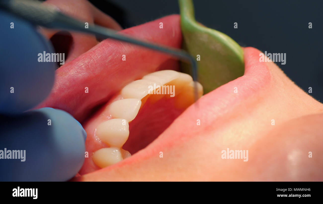 Dentist Checks The Teeth Of Young Girl With Mirror And Flashlight Cosmetic Dentistry Medicine Concept Stock Photo Alamy Dentist Checks The Teeth Of Young Girl With Mirror And Flashlight Cosmetic Dentistry Medicine Concept Stock Photo Alamy