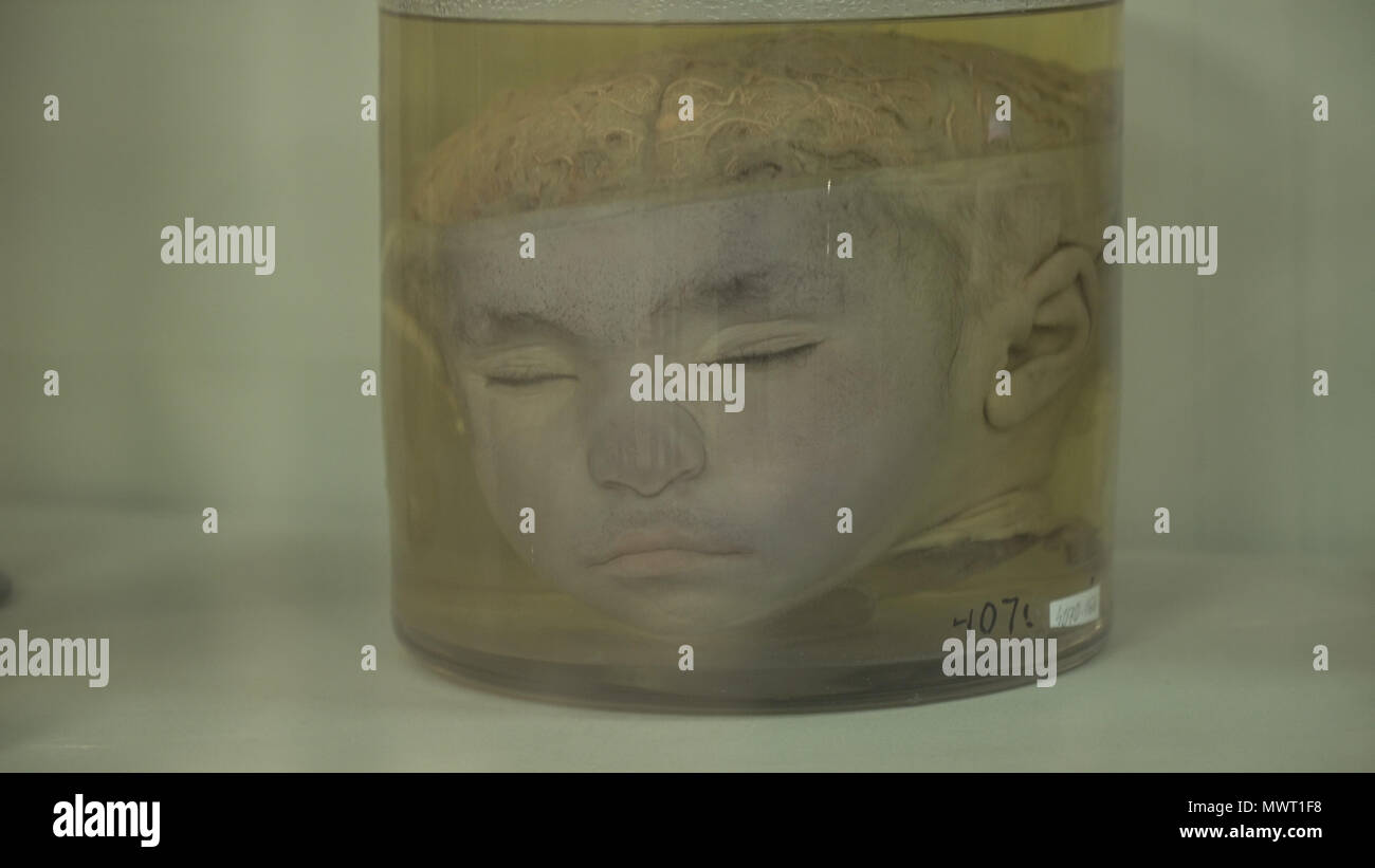 Human Body Exhibition Stock Photos & Human Body Exhibition Stock Images