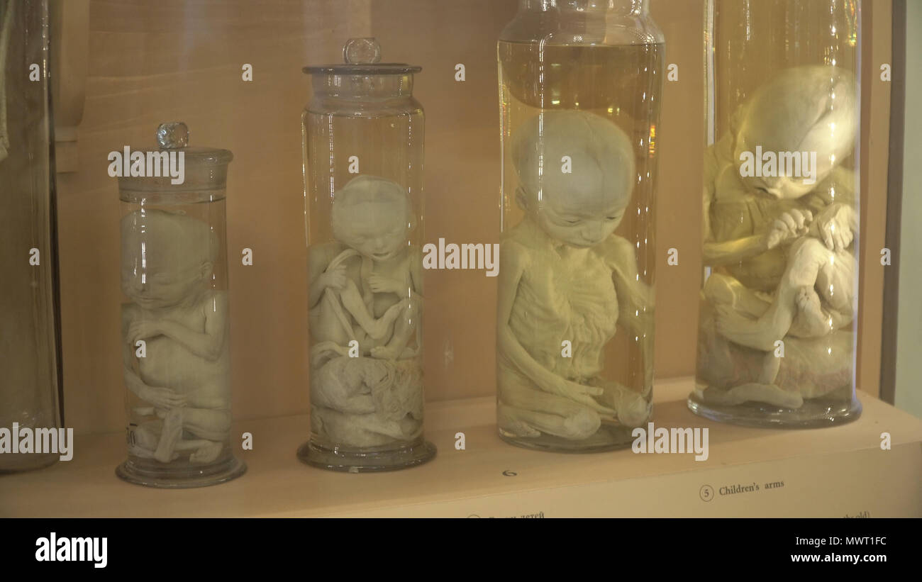 Preserved Specimen Jar High Resolution Stock Photography and Images Alamy