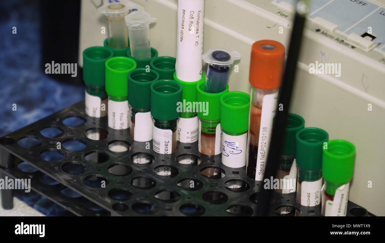 Medical testtube with blood samples in medical laboratory. Many test