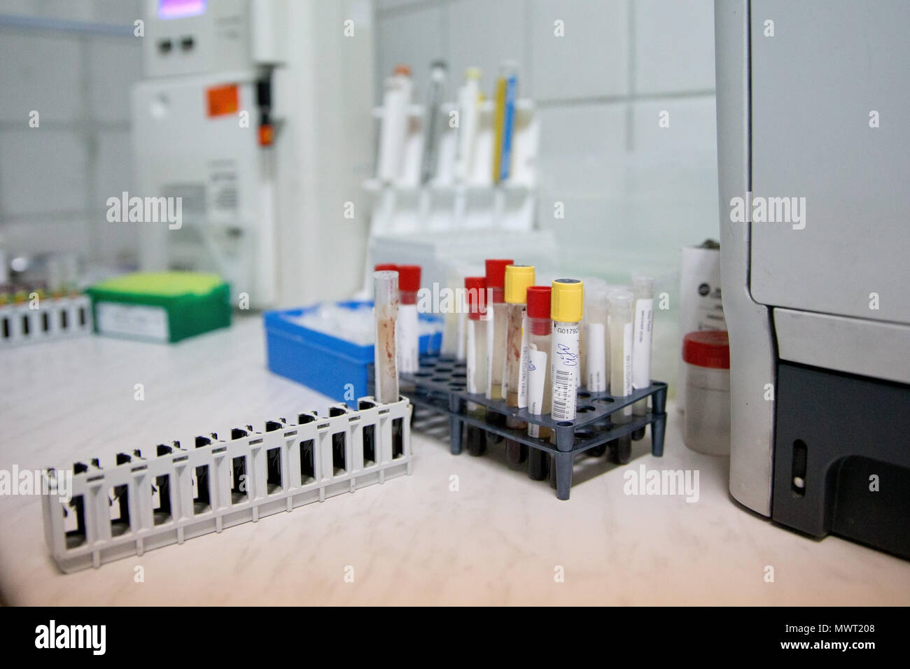 Medical testtube with blood samples in medical laboratory. Many test