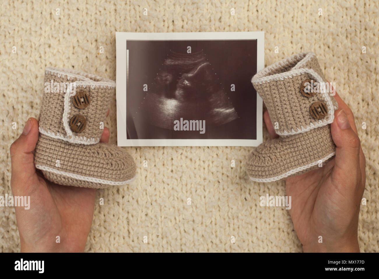 ultrasound photo and baby shoes in woman hands on soft knitted background Stock Photo