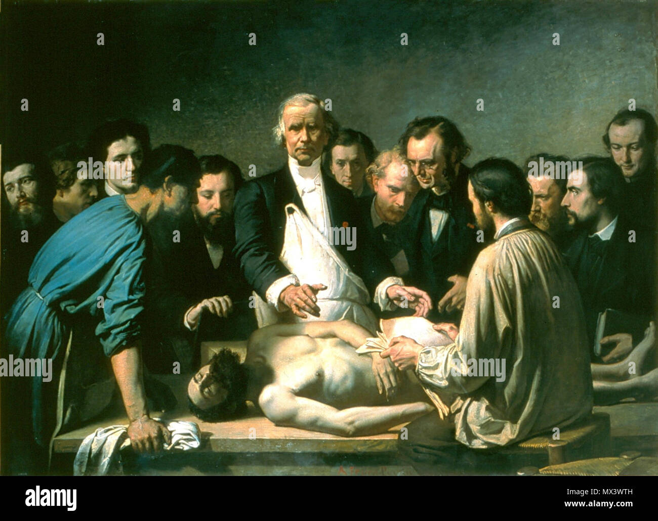 . Painting of French surgeon and anatomist Alfred Velpeau (1795-1867) : 'La Leçon d'anatomie de Velpeau à la Charité' . 1864. François-Nicolas-Augustin Feyen-Perrin (1826-188) 38 Alfred Velpeau 02 Stock Photo