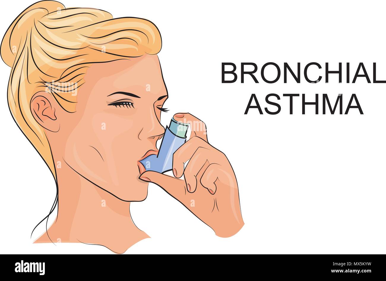 illustration of women suffering from bronchial asthma with an inhaler Stock Vector