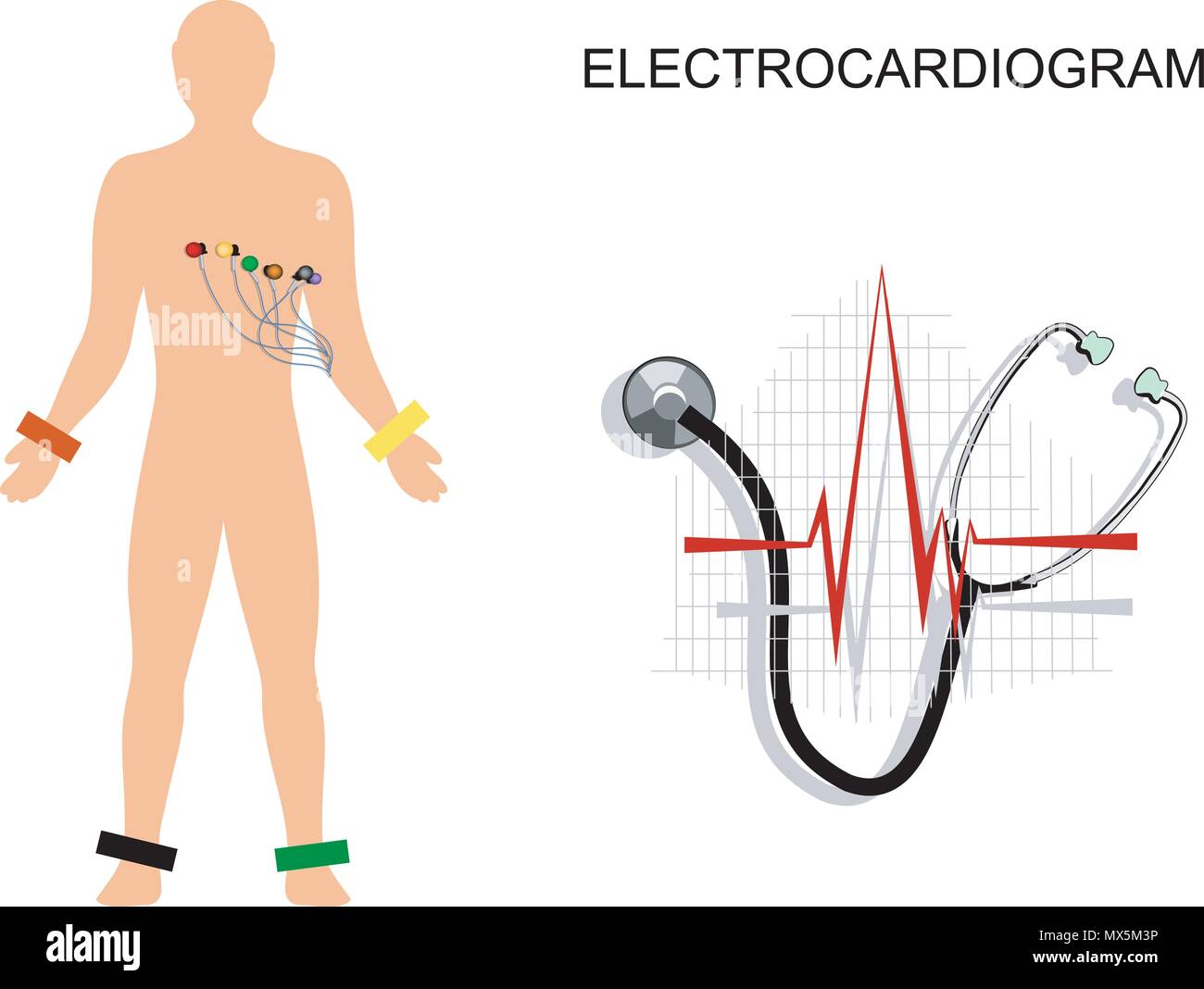 illustration of the electrocardiogram. the patient with electrodes on the chest. Stock Vector
