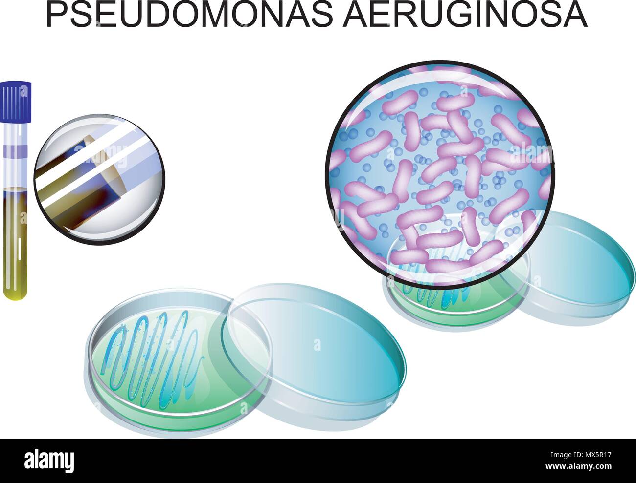 illustration of Petri dishes with sowing superbugs - Pseudomonas aeruginosa Stock Vector