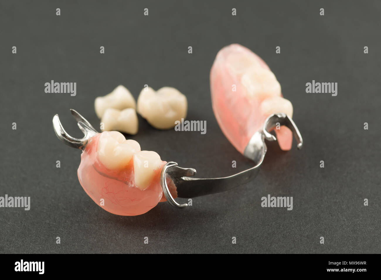 large image of a modern denture on a black background Stock Photo