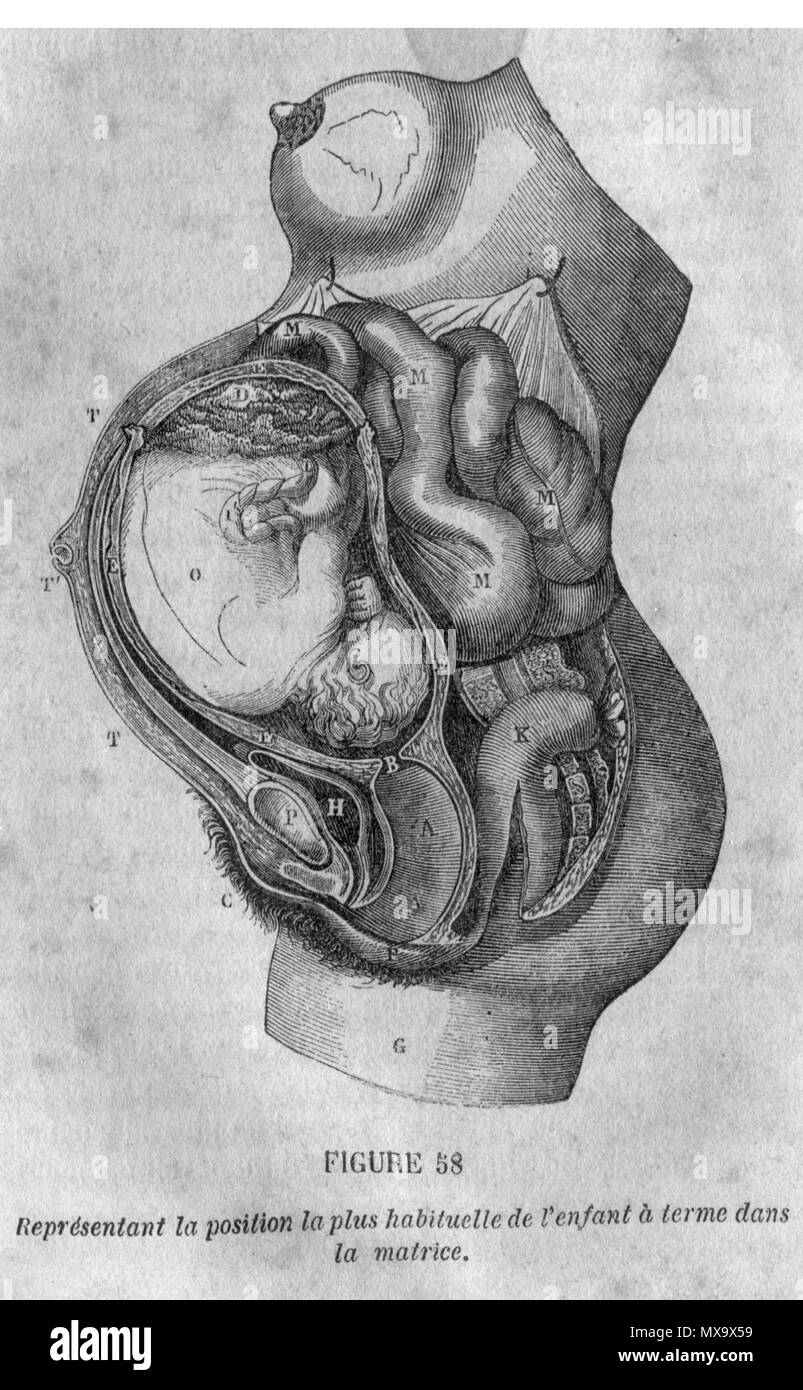 English: Sectional engraving of a pregnant woman showing the fetus into the  womb : the head is toward the bottom of the mother (used in the article  'pregnancy' http://en.wikipedia.org/wiki/Pregnancy). Français :