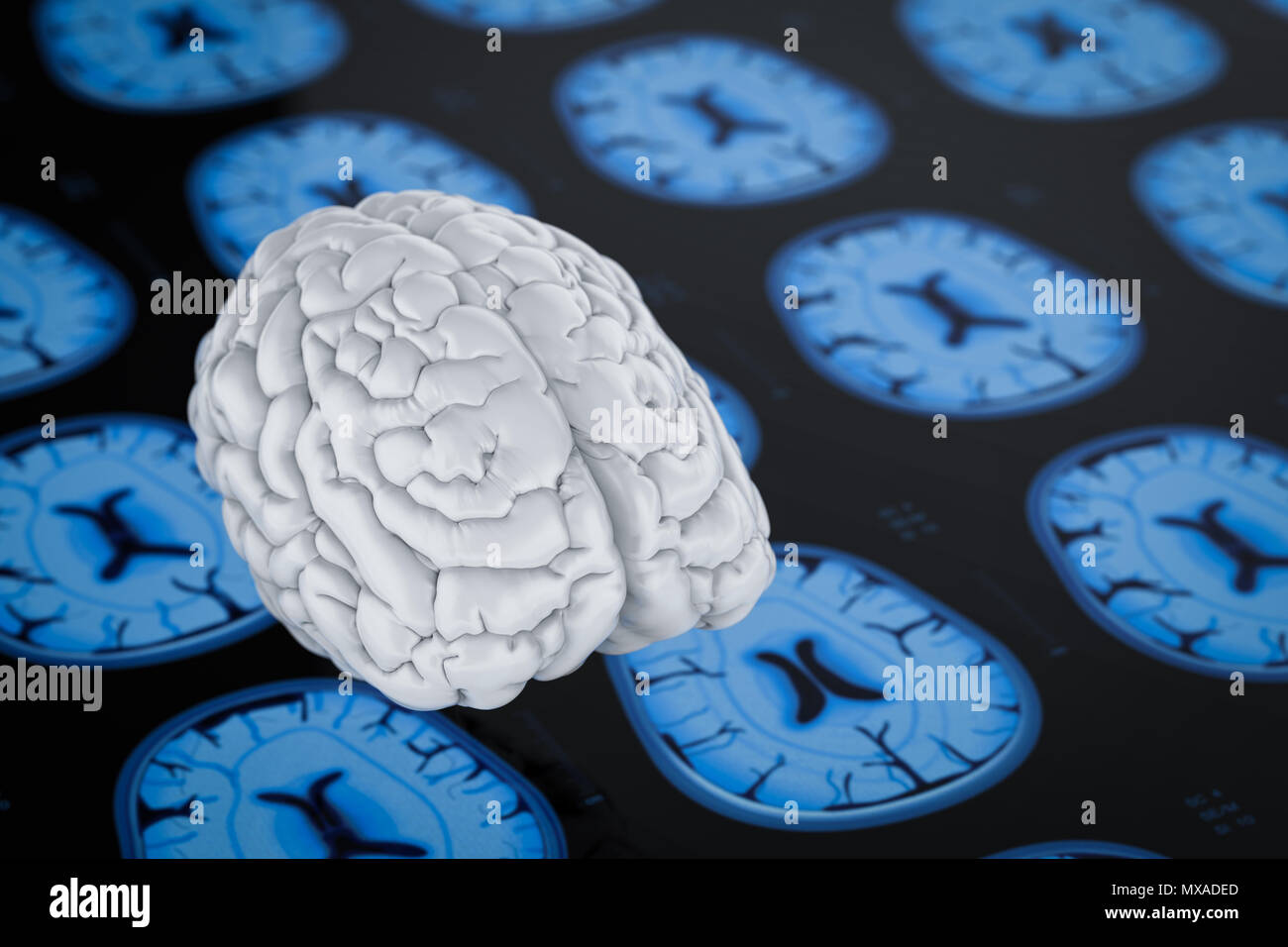 3d rendering human brain with x-ray brain background Stock Photo - Alamy