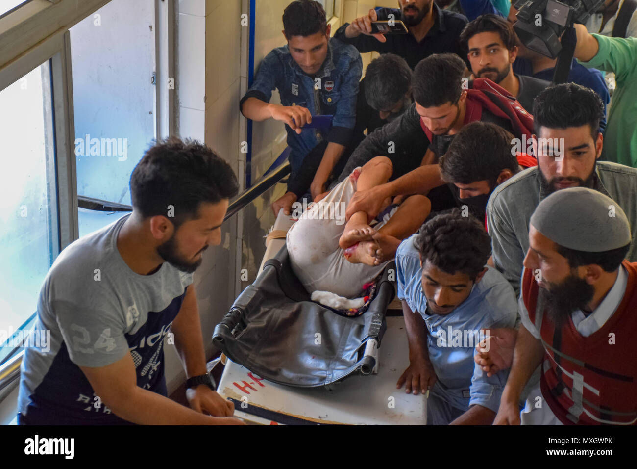 June 4, 2018 - Srinagar, Jammu & Kashmir, India - Kashmiris carry 13-year-old Nadia, who was injured in an explosion, on a stretcher for treatment at a local hospital in Srinagar, Indian Kashmir on Monday. A grenade exploded on a busy road in the southern town of Shopian in Indian-controlled Kashmir wounding at least 12 civilians and four policemen on Monday, police said. Credit: Abbas Idrees/SOPA Images/ZUMA Wire/Alamy Live News Stock Photo