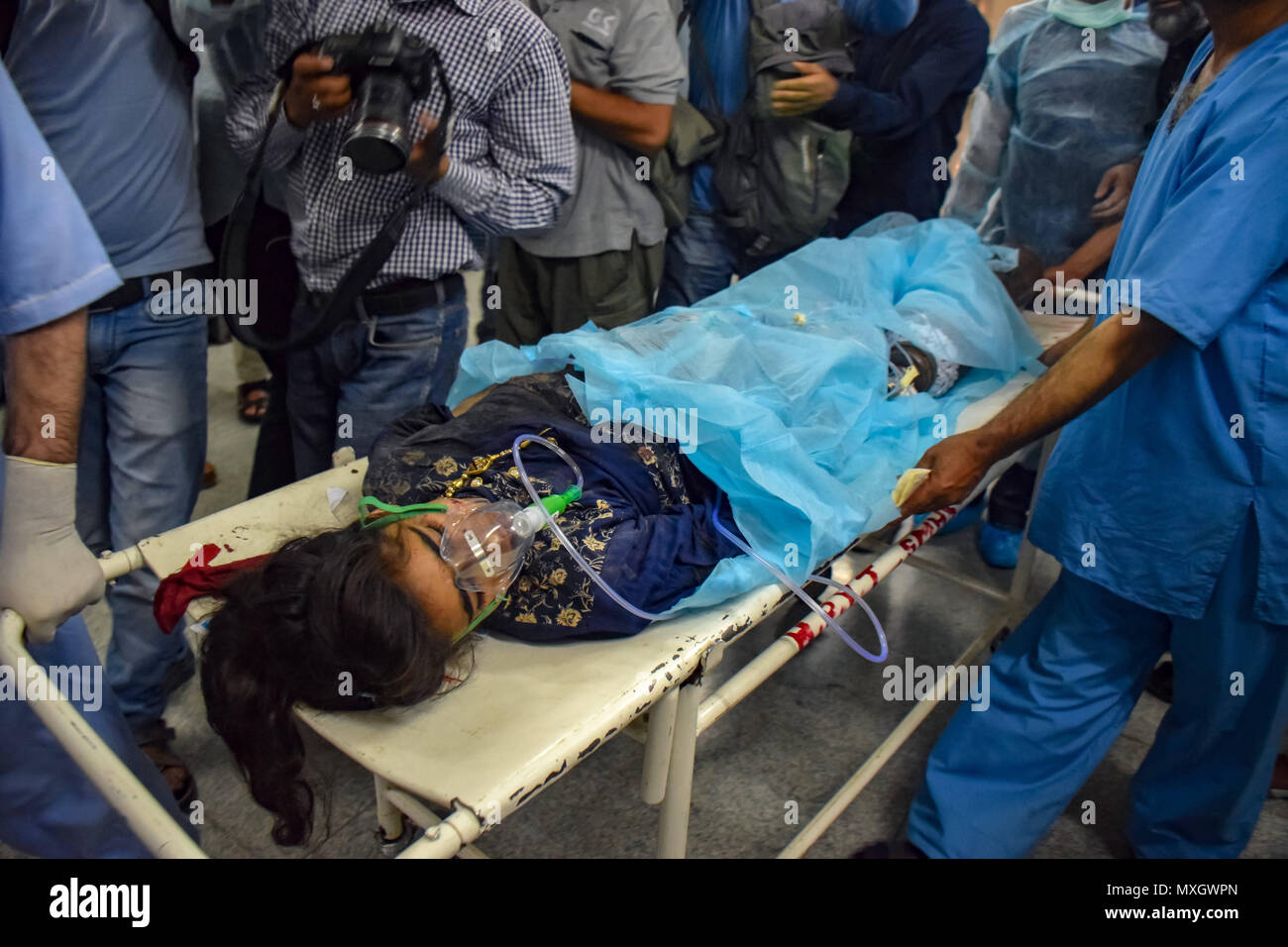 June 4, 2018 - Srinagar, Jammu & Kashmir, India - (EDITORS NOTE: Image contains graphic content) Kashmiris carry 13-year-old Nadia, who was injured in an explosion, on a stretcher for treatment at a local hospital in Srinagar, Indian Kashmir on Monday. A grenade exploded on a busy road in the southern town of Shopian in Indian-controlled Kashmir wounding at least 12 civilians and four policemen on Monday, police said. Credit: Abbas Idrees/SOPA Images/ZUMA Wire/Alamy Live News Stock Photo