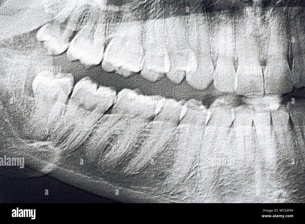 Panoramic xray of the jaw of the man close up Stock Photo Alamy