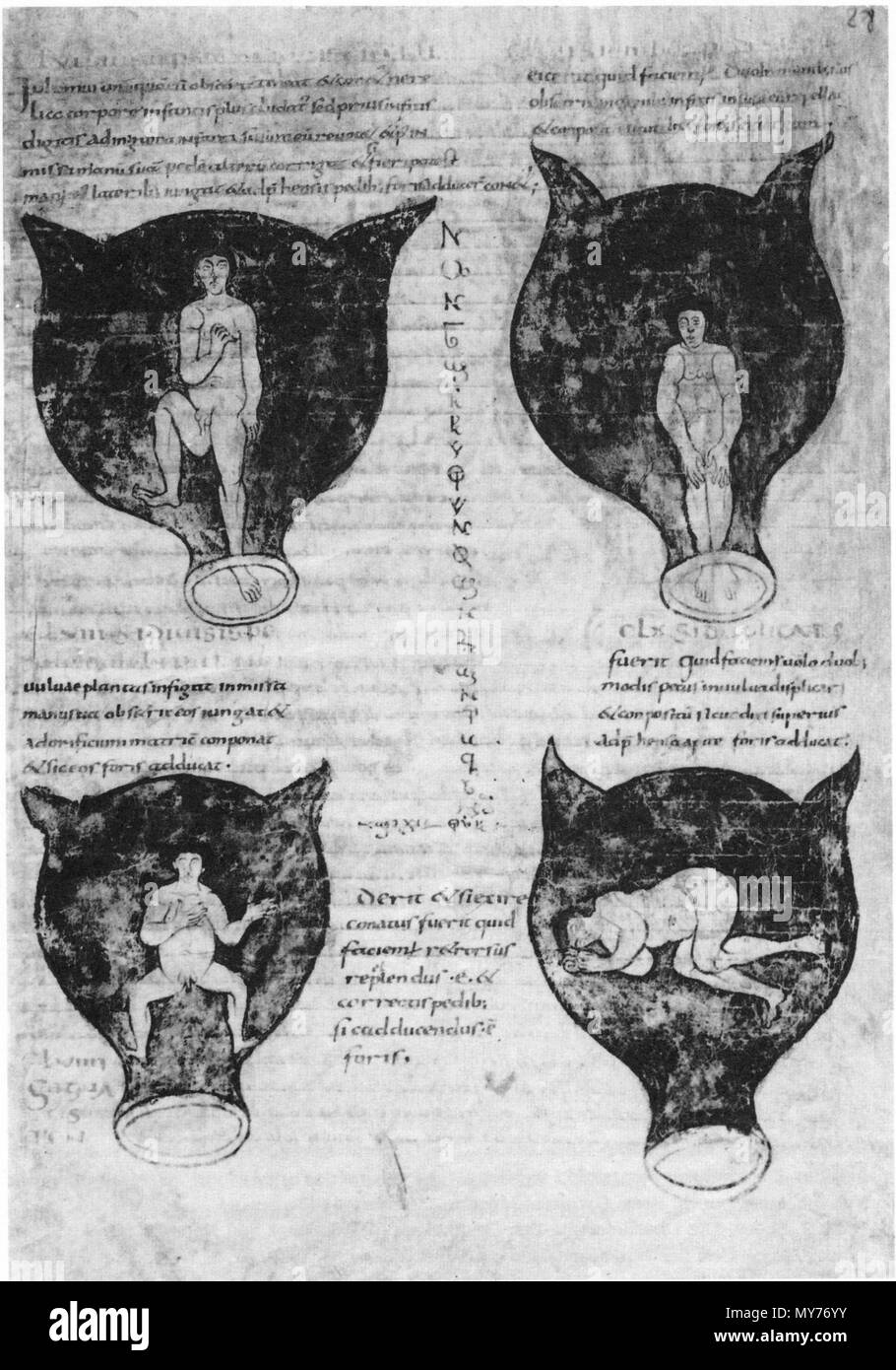 . English: Soranus of Ephesus, Gynaecology, in a Latin version of Late Antiquity: positions of the embryo in the uterus. The illustrations in this medieval manuscript are probably based on drawings by Soranus. Brussels, Bibliothèque Royale, Codex 3714, fol. 28r. Deutsch: Soranos von Ephesos, Gynäkologie, in einer spätantiken lateinischen Bearbeitung: Darstellungen von Kindslagen (Embryonen im Uterus). Die Abbildungen in dieser mittelalterlichen Handschrift gehen wohl ursprünglich auf Zeichnungen des Soranos zurück. Bruxelles, Bibliothèque Royale, Codex 3714, fol. 28r. circa 900. Soranus of Eph Stock Photo