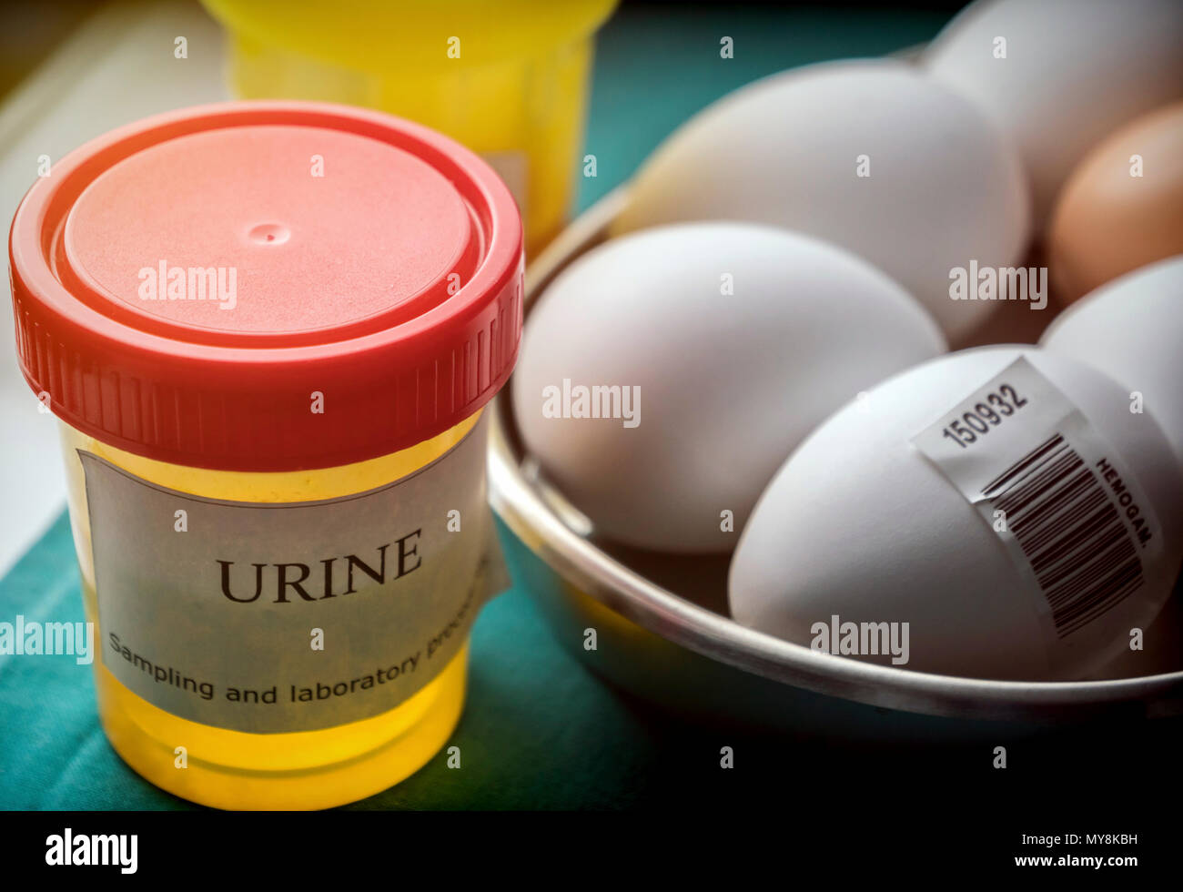 Urine samples and eggs in poor condition for examination in clinical