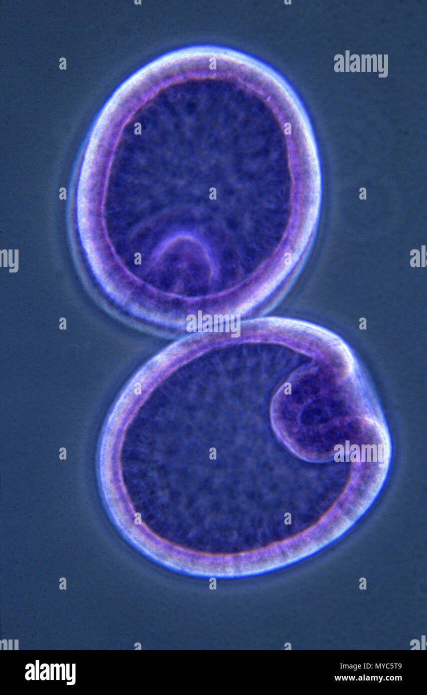 Gastrula.Starfish Stock Photo