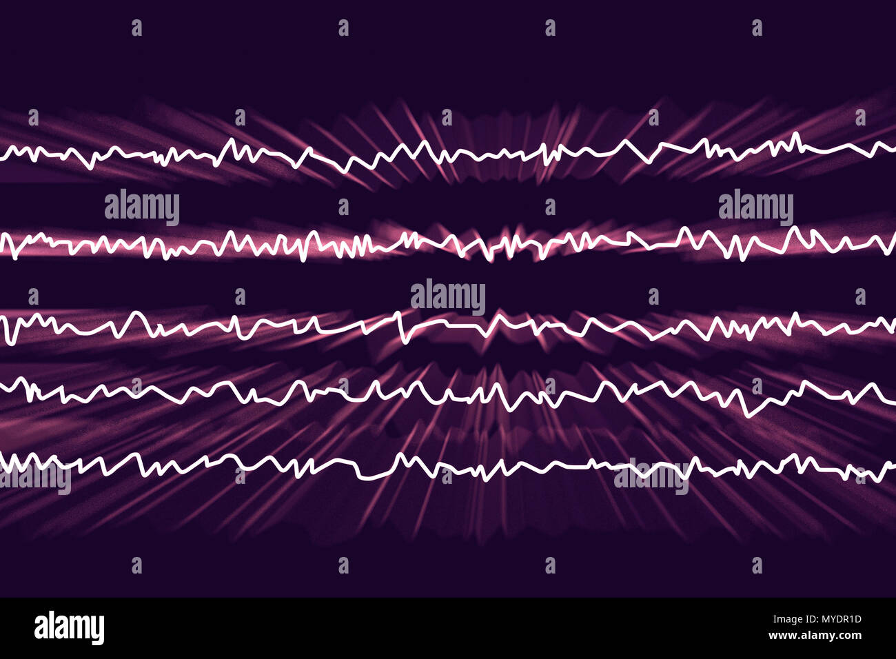 Brain waves in awake state with mental activity, computer illustration. An electroencephalogram (EEG) measures electrical activity in the brain using electrodes attached to the scalp. Various disorders can be diagnosed by analysing EEG results. Stock Photo