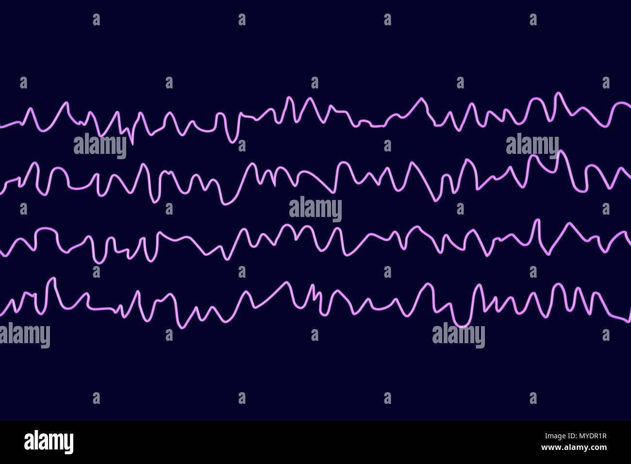 Brain waves in awake state during rest hires stock photography and