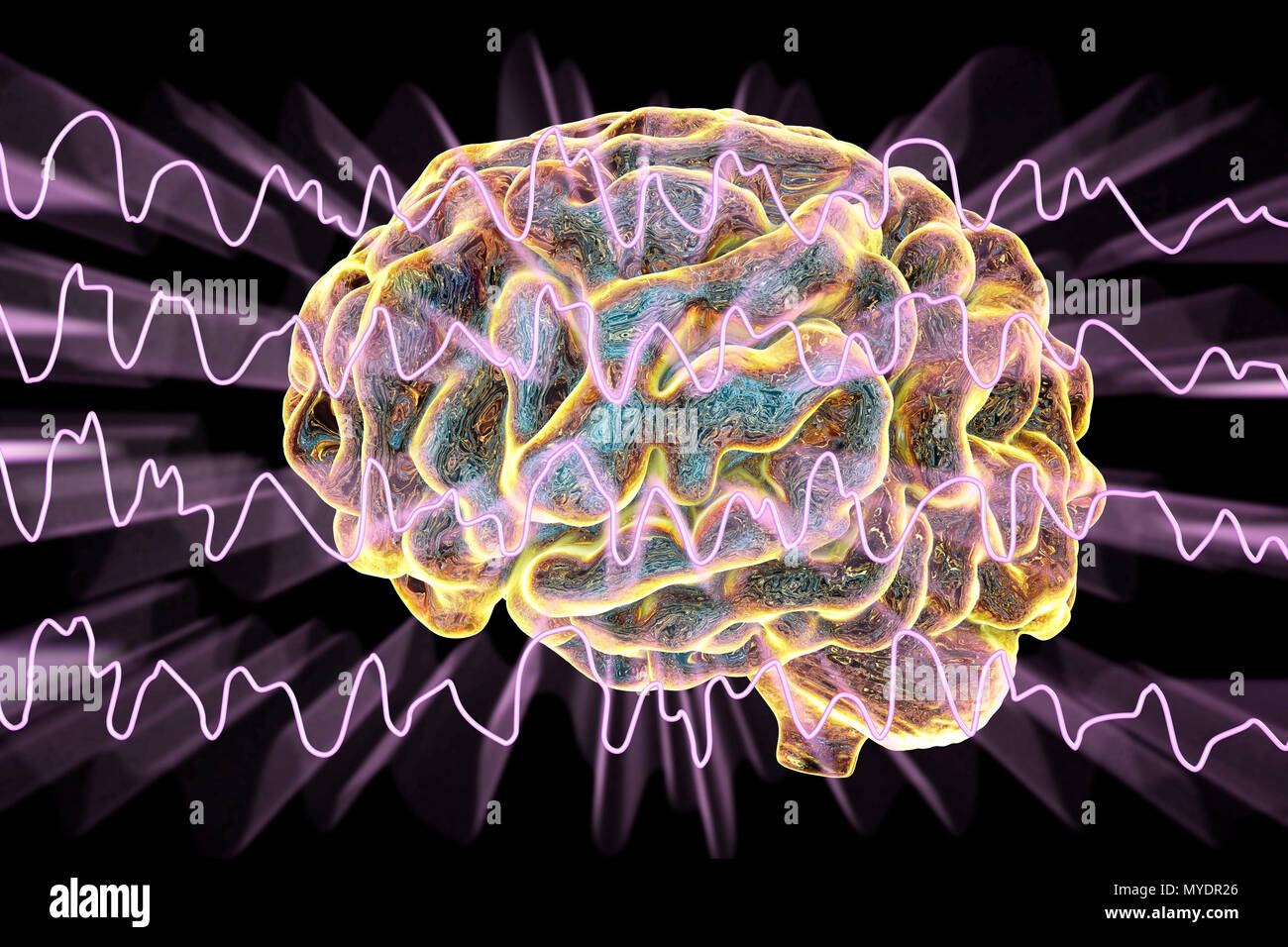 eeg results eeg results
