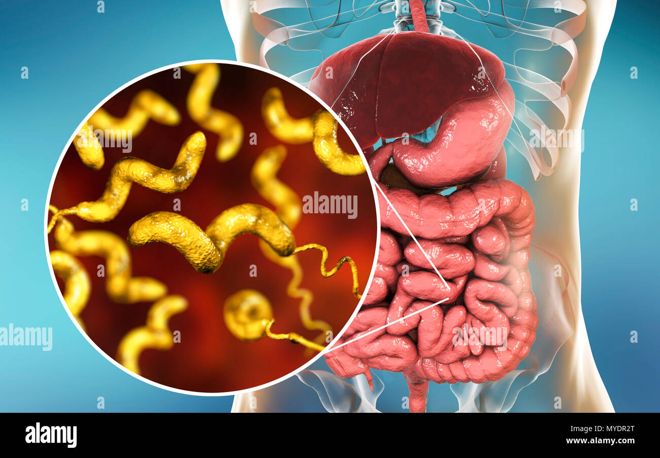 Campylobacteriosis, conceptual illustration. Campylobacter jejuni is a motile, Gram-negative bacterium with a long flagella at one end that is used for locomotion. It can grow in environments where little oxygen is present. It is a common cause of gastroenteritis in humans, especially children and young adults. Contaminated poultry, meat and milk are sources of infection. Symptoms include fever and acute abdominal pain, followed by watery and often bloody diarrhoea. Recovery is usually rapid. Stock Photo