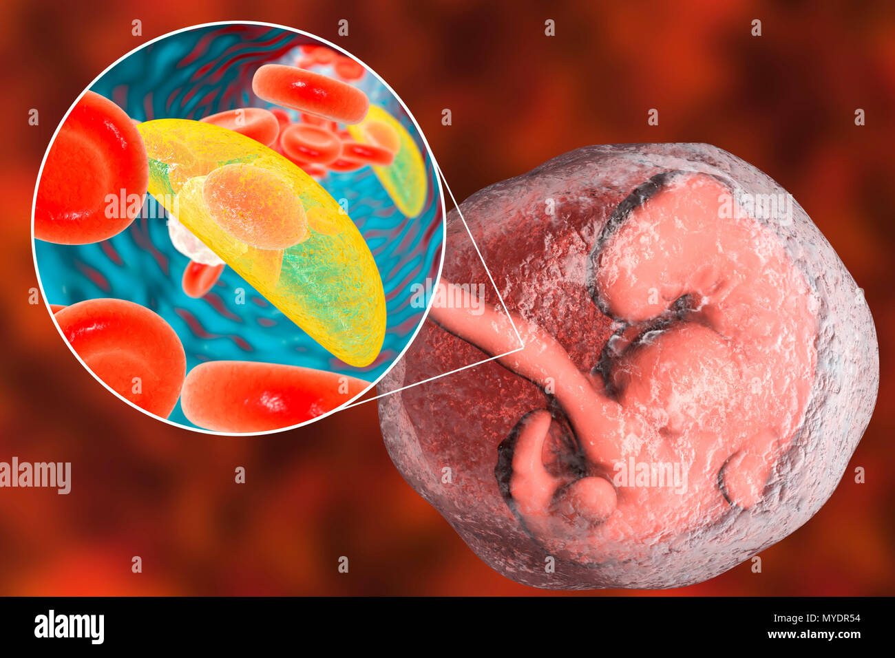 Toxoplasma Gondii Stock Photos & Toxoplasma Gondii Stock Images - Alamy