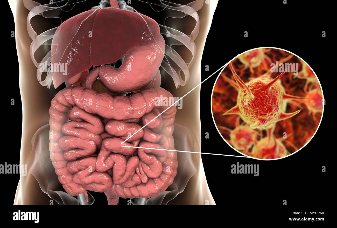 Computer illustration of abstract pathogenic microorganisms in human large intestine. Stock Photo