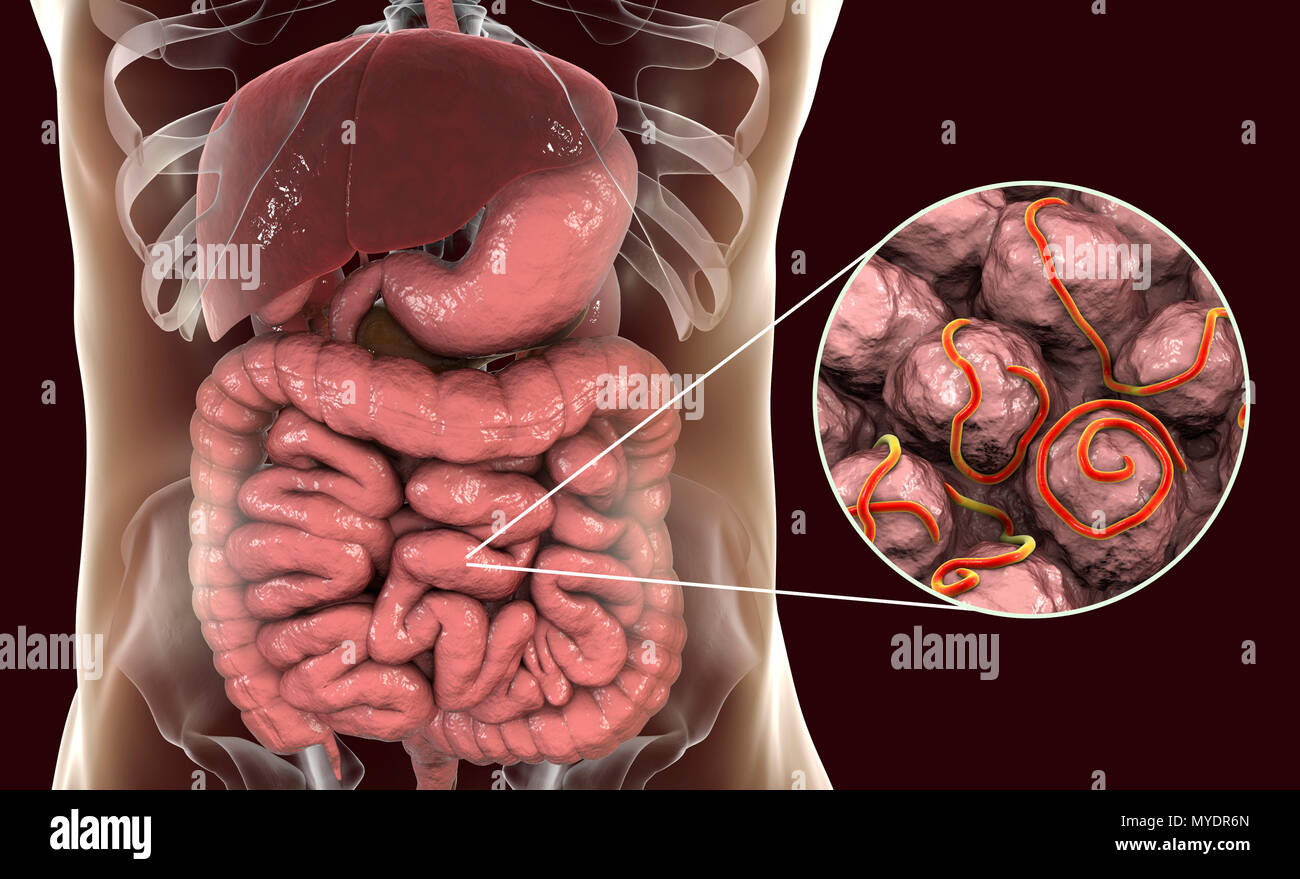 Threadworms hires stock photography and images Alamy