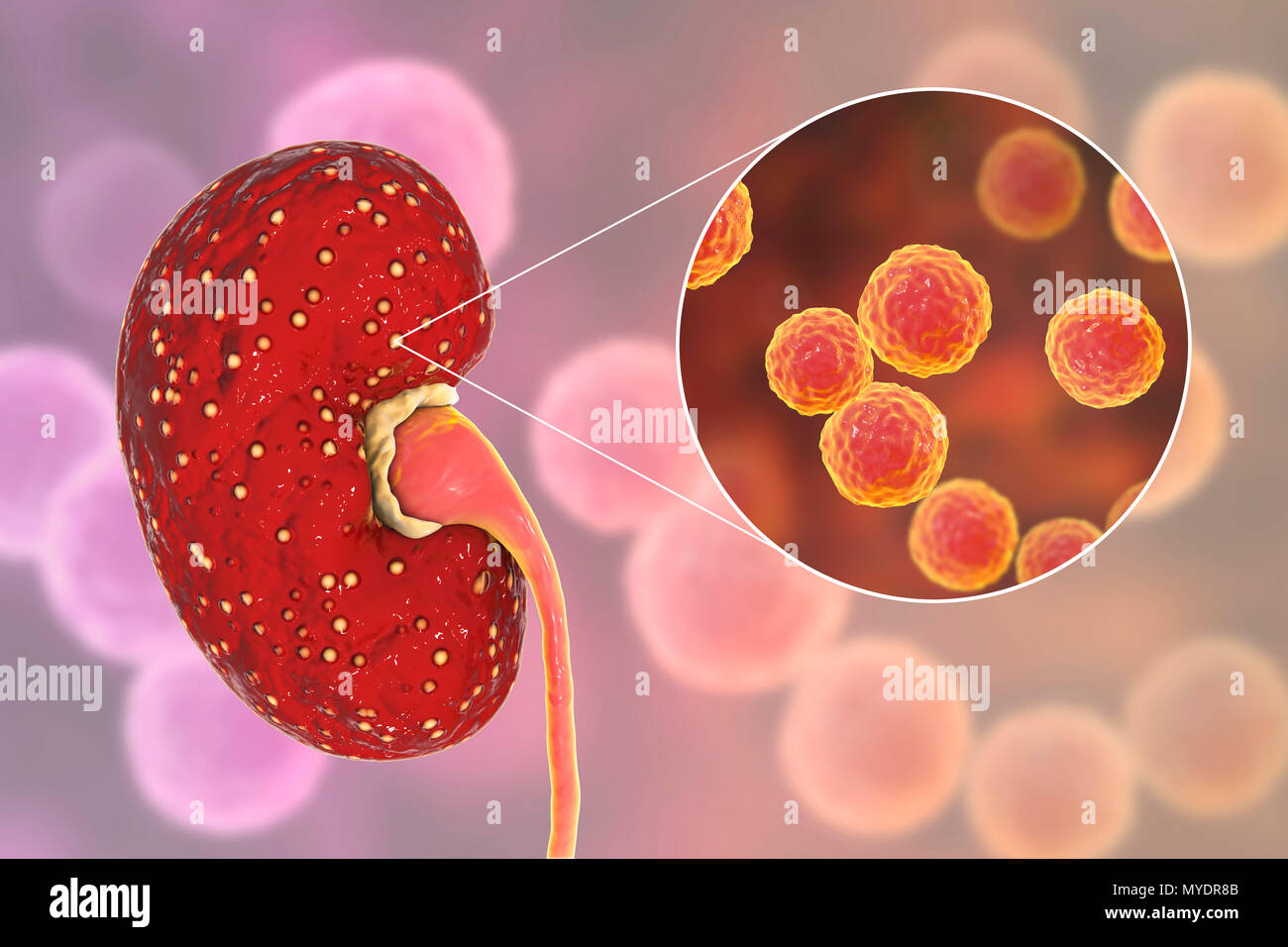 How to recognize and treat cystitis (acute and chronic form) How to recognize and treat cystitis (acute and chronic form)