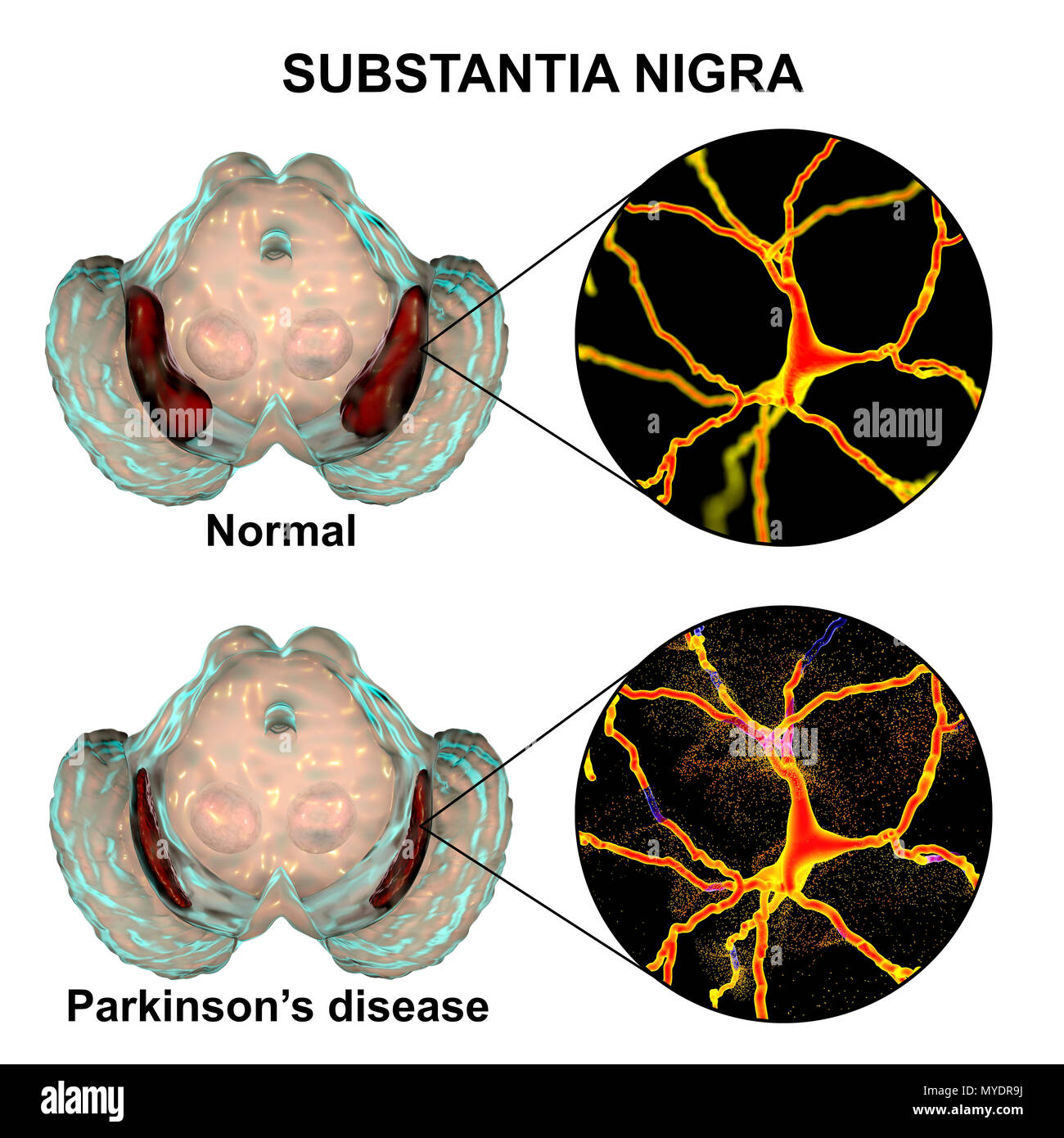 Substantia Nigra High Resolution Stock Photography And Images Alamy