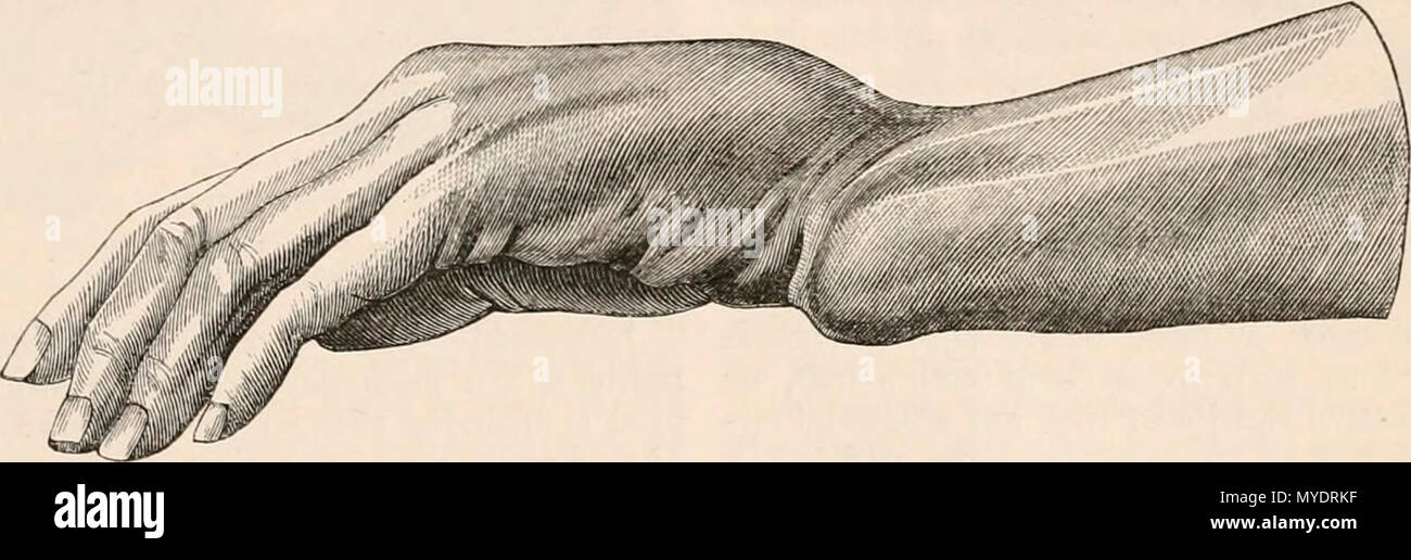 Dinner fork Deformity Stock Photo Alamy