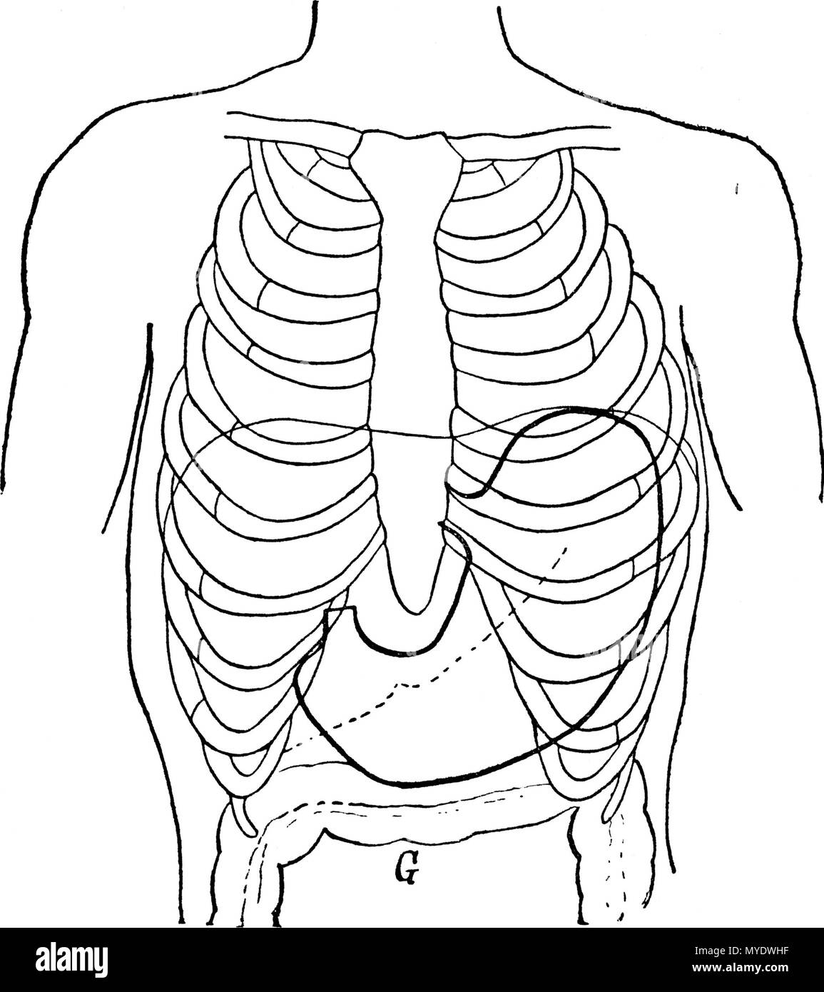 . Français : Figure 1 (d'après Boas); THORAX ET ESTOMAC NORMAUX; - - - - - - Bord inférieur du foie.           Diaphragme. G Gros intestin. English: Figure 1 (according to Boas); NORMAL THORAXES AND STOMACH; - - - - - - lower Edge of the liver           Diaphragm. G Large intestine . 1892. Le dr Eugène Chapotot 169 EstomacCorset page017 Stock Photo
