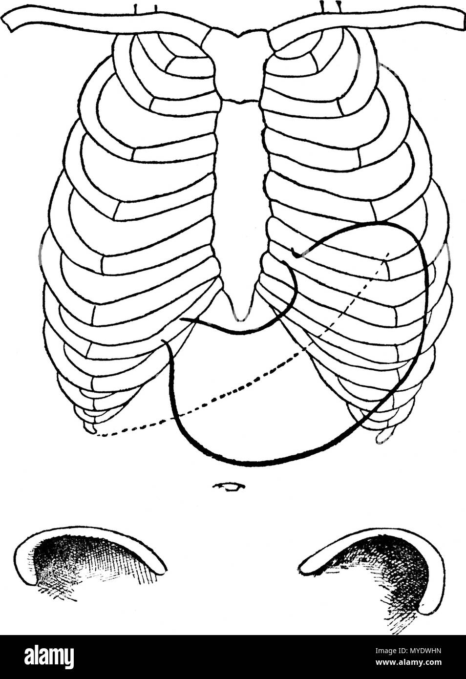 . Français : Figure 3 (d'après Rosenheim); ESTOMAC NORMAL, INSUFFLÉ; - - - - - - Bord inférieur du foie. 1892. Le dr Eugène Chapotot 169 EstomacCorset page022 Stock Photo