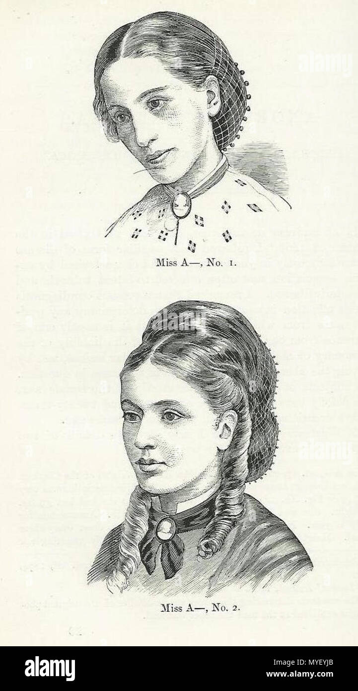 . English: This image is a reproduction of two photographs taken in 1866 and 1870 (photographer unknown). It depicts Miss A, an unnamed patient of William Withey Gull, before and after treatment for anorexia nervosa. Gull used these images to illustrate his 1873 paper 'Anorexia Nervosa (Apepsia Hysterica, Anorexia Hysterica)' in which anorexia nervosa was described and which first established the name of the condition. 14 March 1894. William Withey Gull, Bart, M.D., F.R.S.; edited by Theodore Dyke Acland, M.D. 222 Gull - Anorexia Miss A Stock Photo