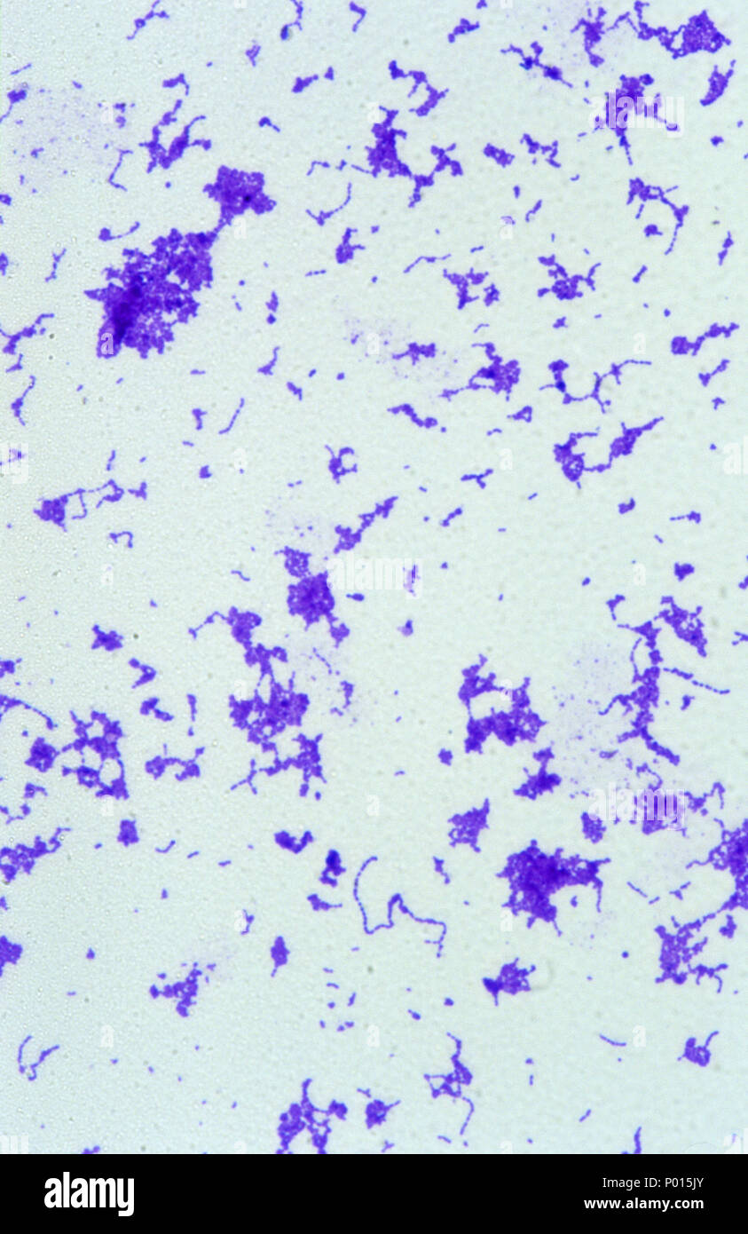 Streptococcus pyogenes bacterium Stock Photo