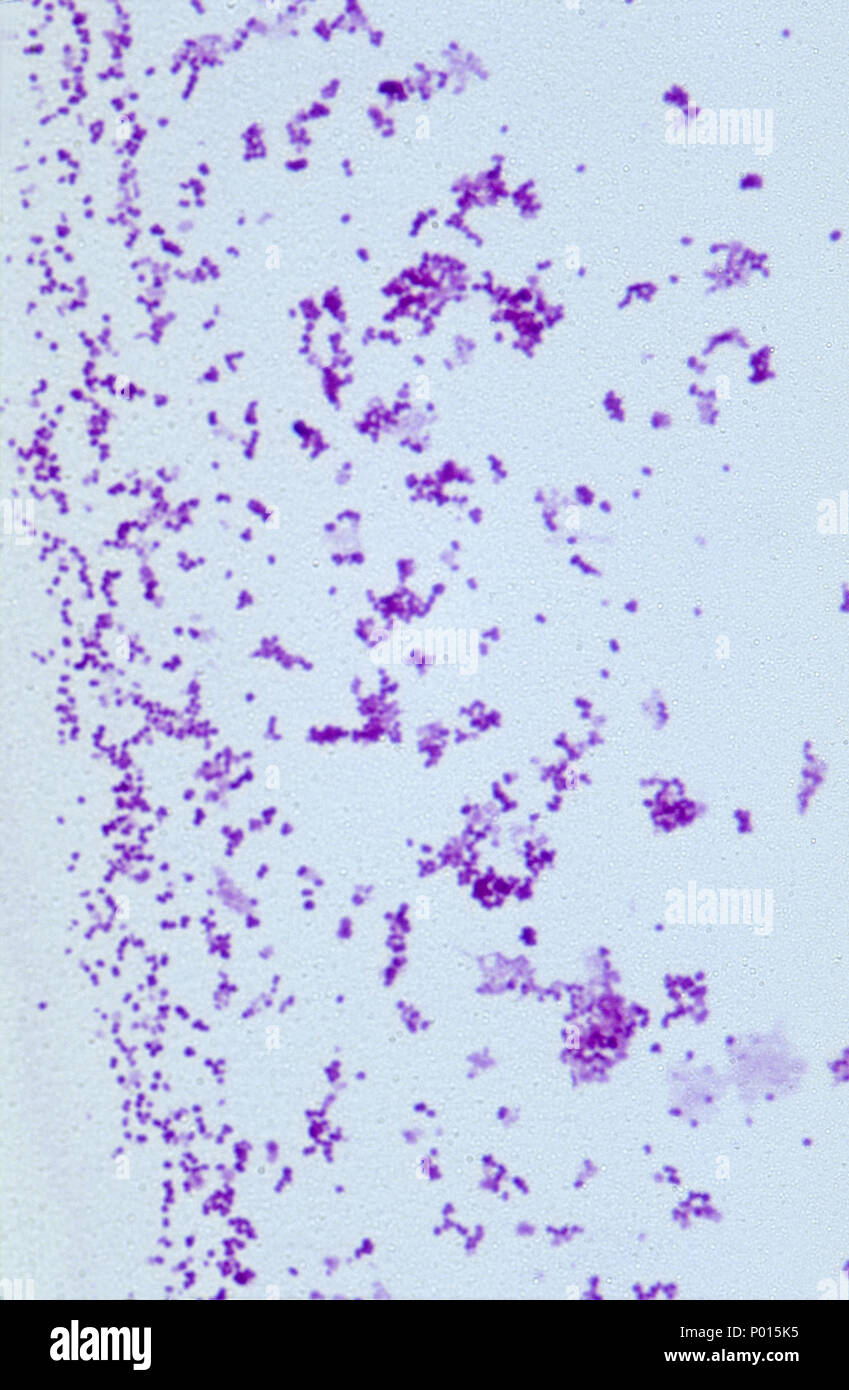 Neisseiria gonorrhoeae bacteria Stock Photo