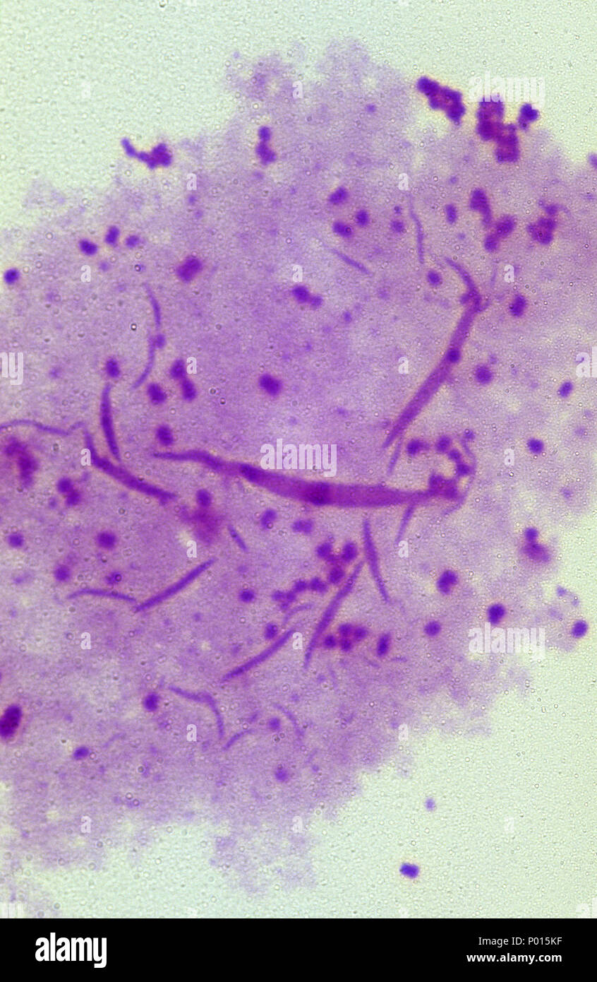 Neisseiria gonorrhoeae bacterium Stock Photo