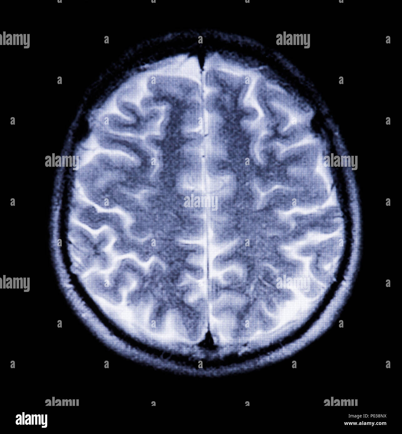 Snapshot of the brain in cross section in magnetic resonance imaging ...