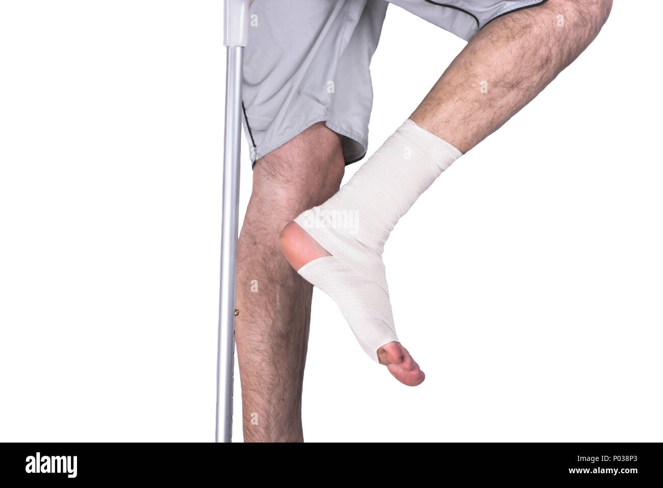 Перебинтованная нога мужская. Как бинтовать ноги перед операцией