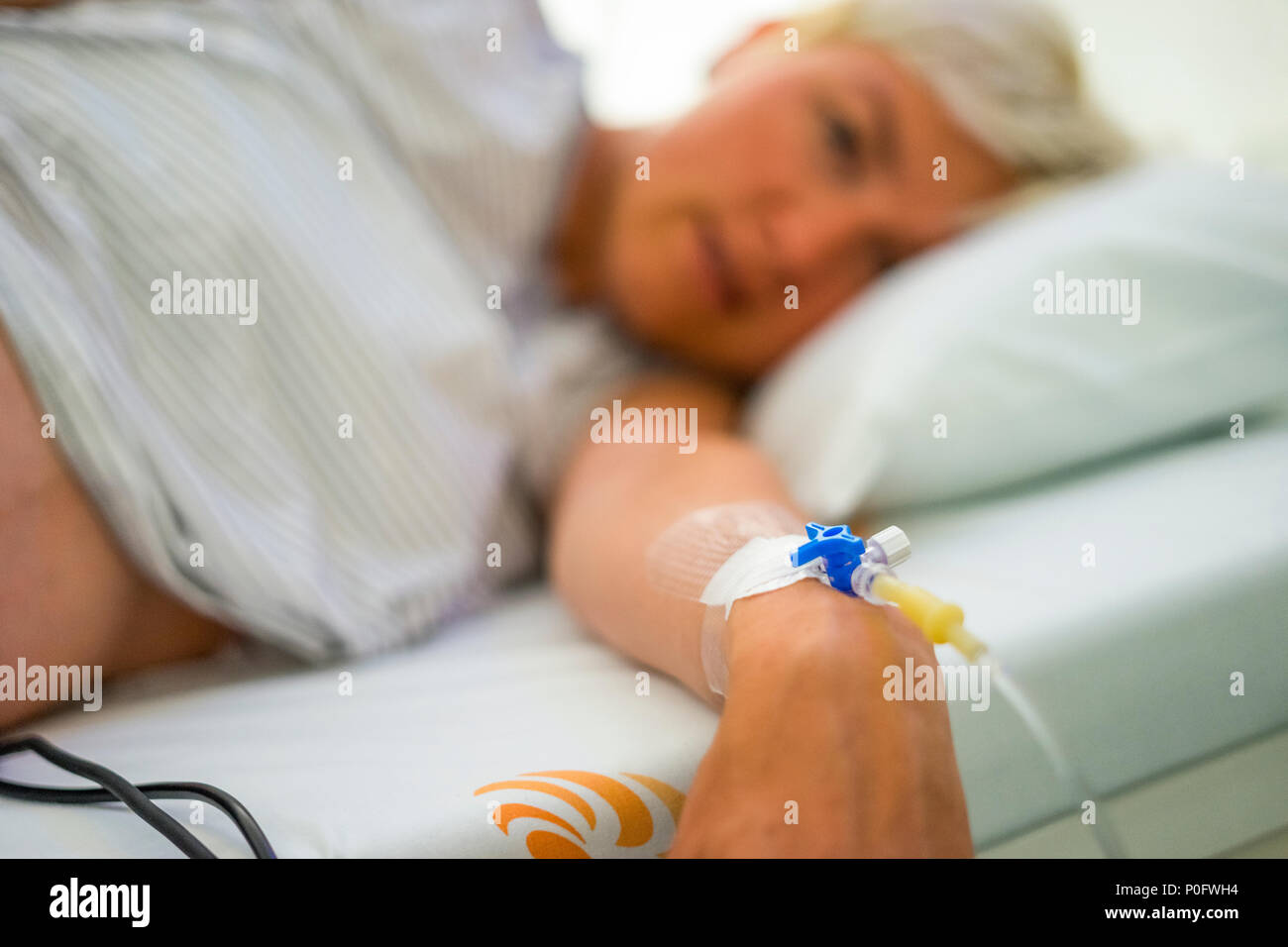 Peripheral venous catheter on the hand of young Caucasian woman Stock Photo
