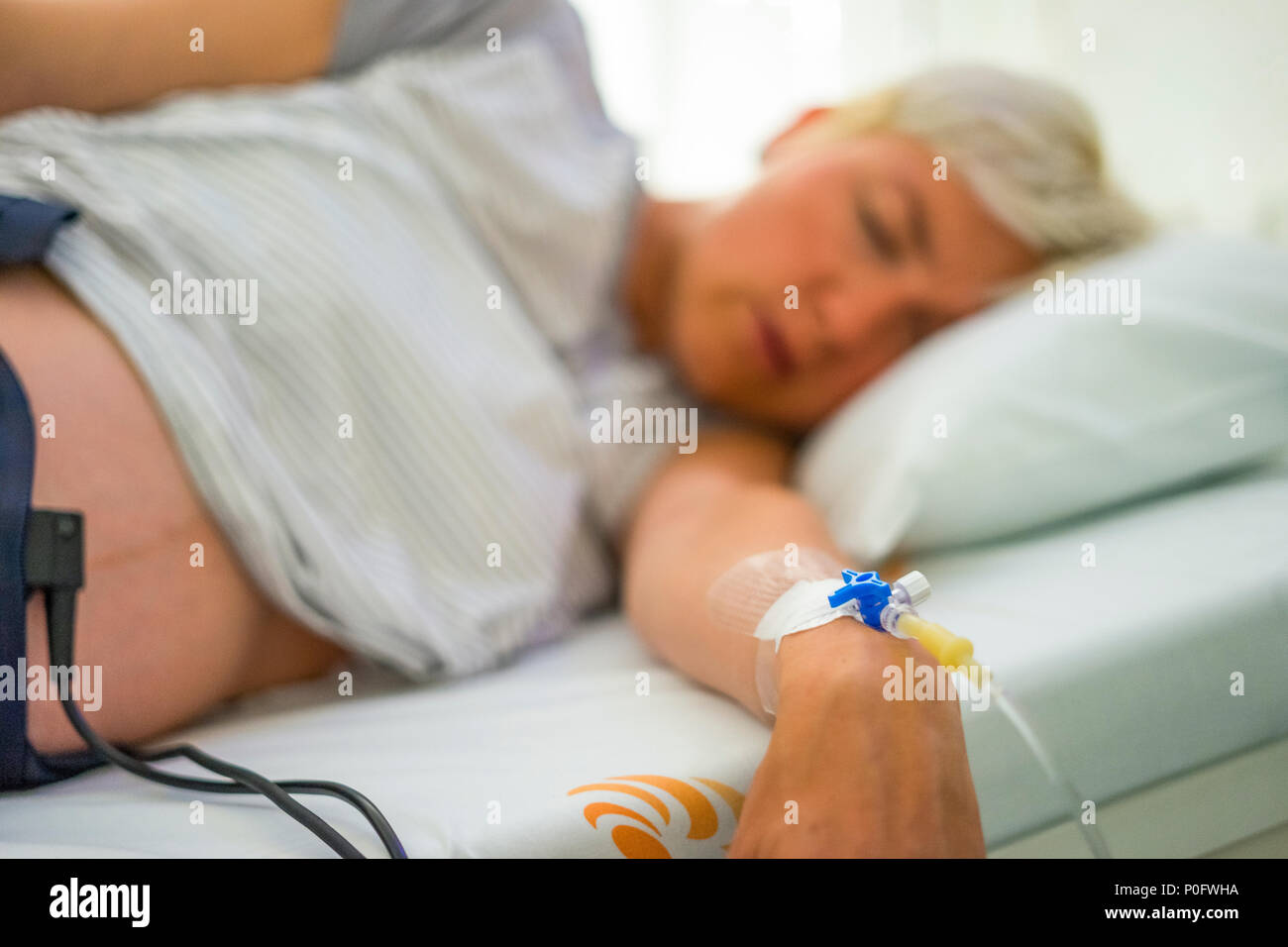 Peripheral venous catheter on the hand of laying down, pregnant woman Stock Photo