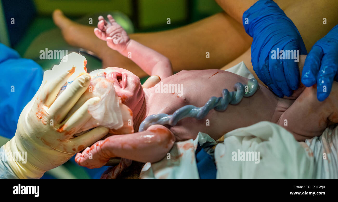New born baby boy with umbilical cord assisted by midwife Stock Photo