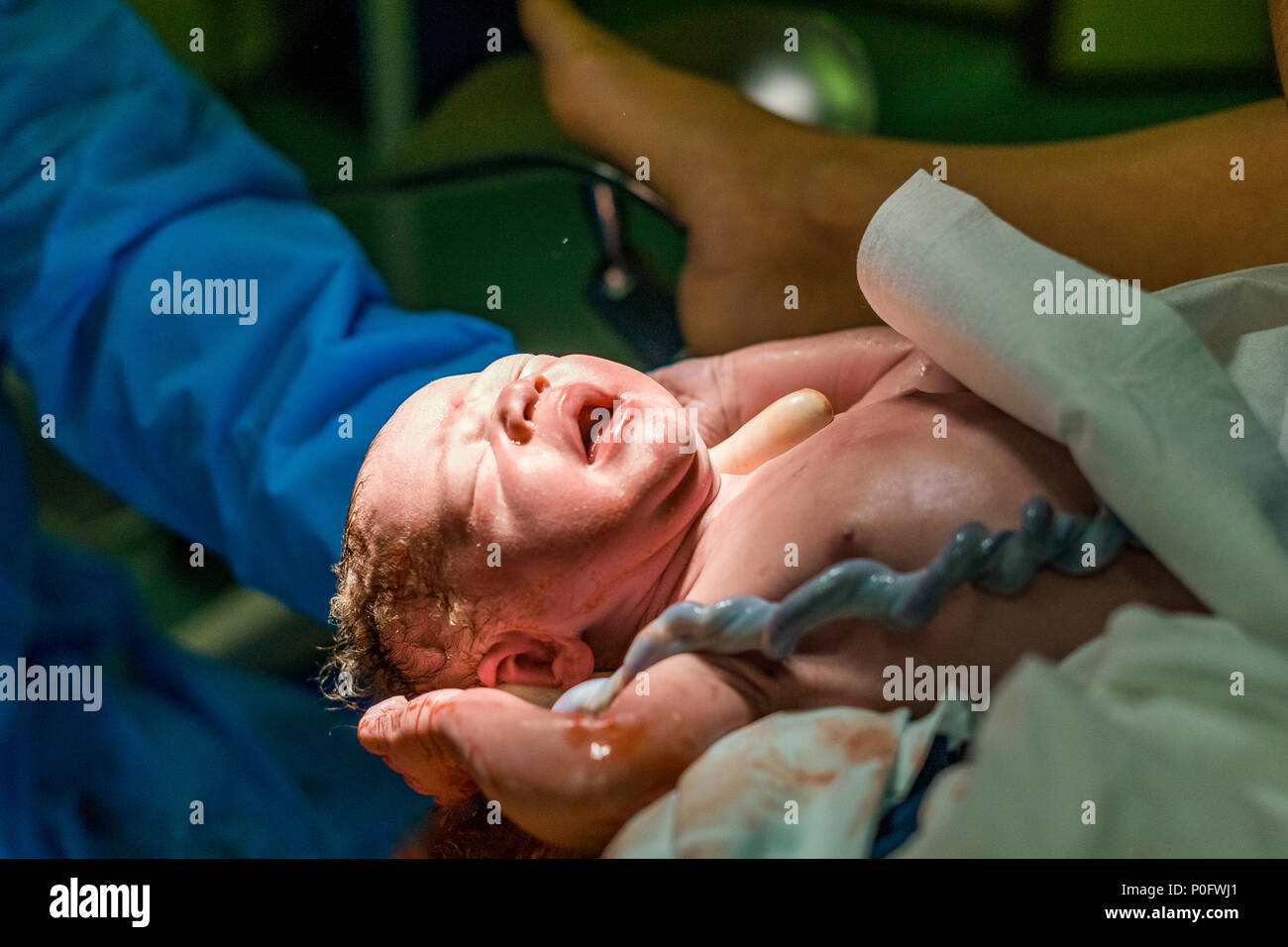 New born baby boy with umbilical cord assisted by midwife Stock Photo