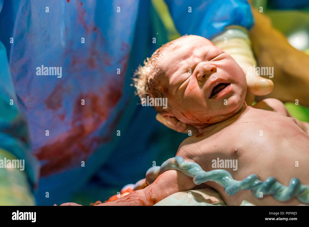 Newborn baby boy with umbilical cord assisted by midwife Stock Photo