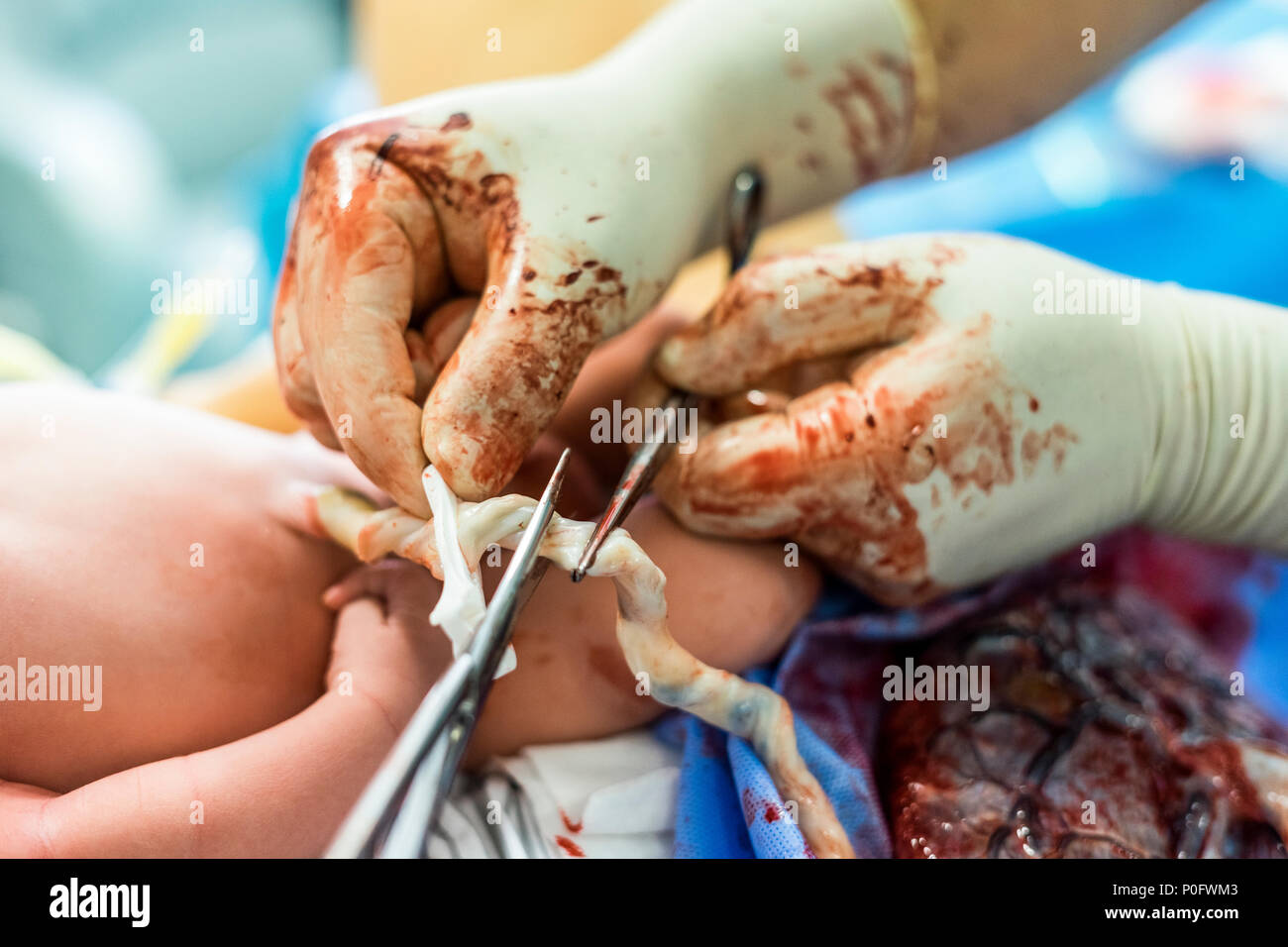 Father cuts the umbilical cord between a newborn baby and placenta Stock Photo